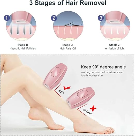 IPL Laser Hair Removal – جهاز إزالة الشعر بالليزر IPL